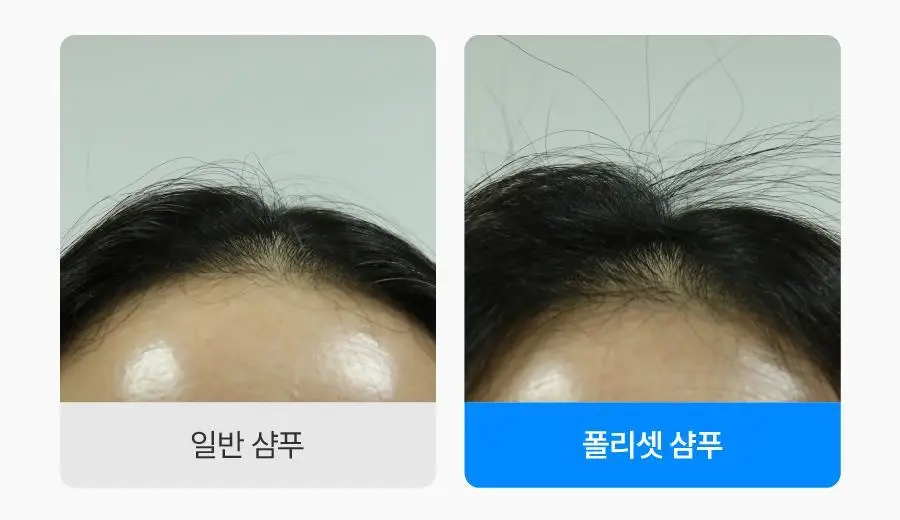 [NEW/볼륨 UP] 씨퓨리 닥터33 폴리셋 샴푸 290ml 상세페이지 25